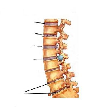 Osteokondrosia nola garatzen den